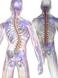 Scoliosis vers alignement 2